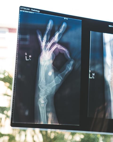 rentgen - smieszne zdjecie rendgenowski